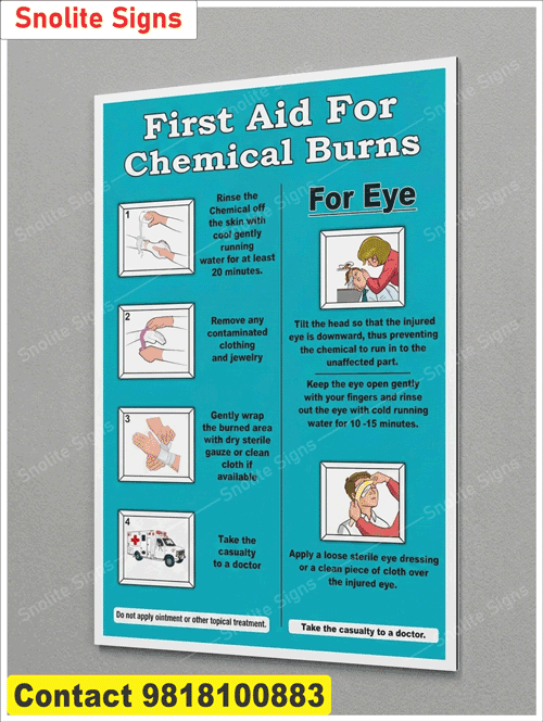 Chemical Burn First Aid Poster in English, Laminated Chemical Burn First Aid Poster, OSHA Compliant Chemical Safety Poster, Laboratory Chemical Burn First Aid Poster, Chemical Plant Burn Response Poster, Warehouse First Aid Wall Chart